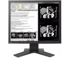 Monitor EIZO RadiForce MX194