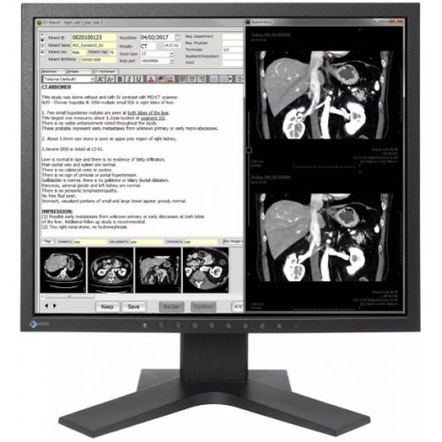 Monitor EIZO RadiForce MX194