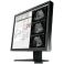 Monitor EIZO RadiForce MX194